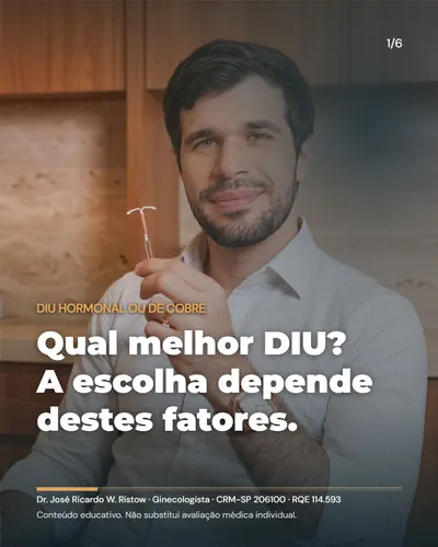 Qual o melhor DIU? A escolha entre o hormonal e o de cobre depende destes fatores.